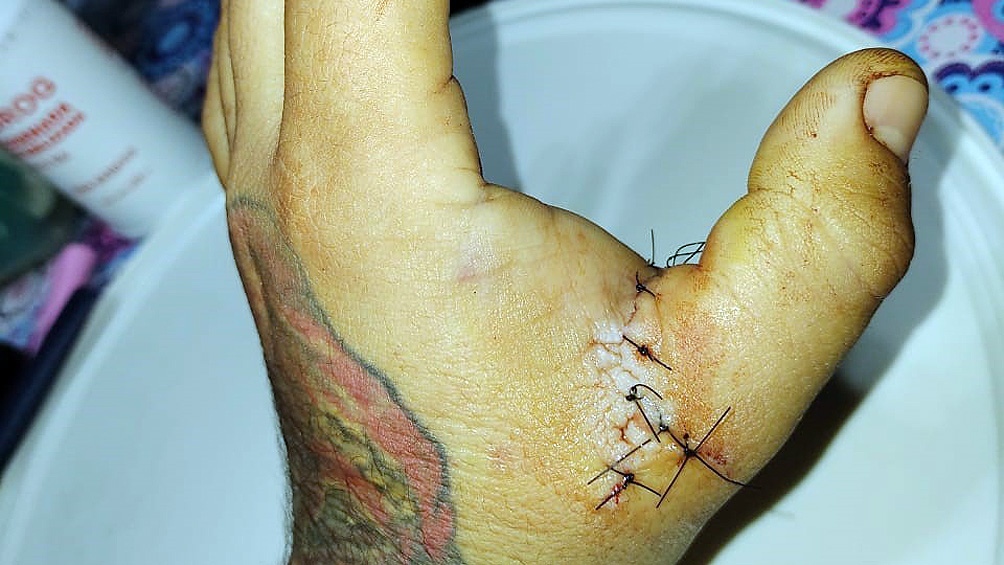 Su hija fue tatuada sin su consentimiento, fue al local con un cuchillo y lesionó a un tatuador