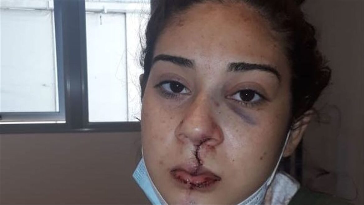 Una mujer denunció que la policía la golpeó hasta sacarle los dientes