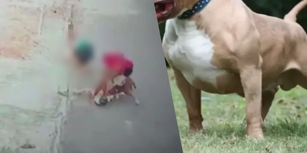 Dos jóvenes fueron atacados por pitbulls, uno perdió un dedo y parte de la oreja