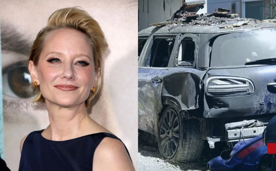 La actriz Anne Heche, que tenía muerte cerebral, fue desconectada de la asistencia mecánica