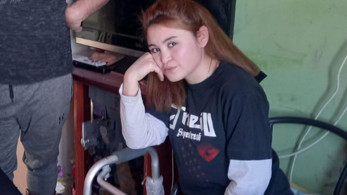 Una adolescente fue atacada por un pitbull y un sharpei, recibió 72 puntos y no puede caminar