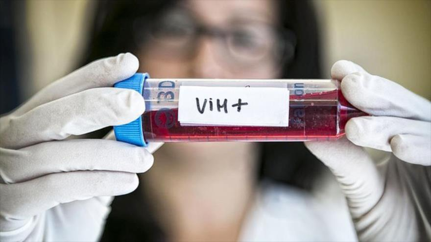 Tercer caso en el mundo de curación del VIH luego de un trasplante de células madre