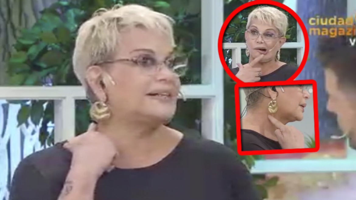 Carmen Barbieri tiene culebrilla y le recomendaron un tratamiento horrible