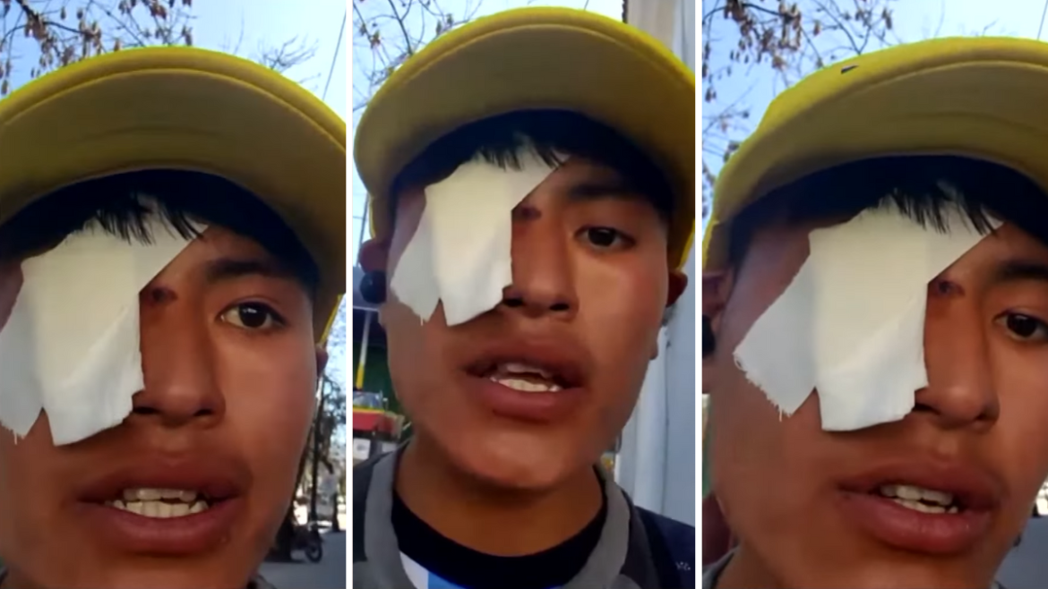Un joven perdió un ojo por una bala de goma que recibió durante la represión policial en Jujuy