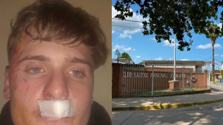 Piden justicia para un joven que recibió una brutal golpiza a la salida del boliche