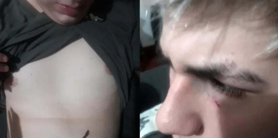 Un adolescente denunció que fue golpeado por dos patovicas a la salida de un boliche en la localidad de Moreno.