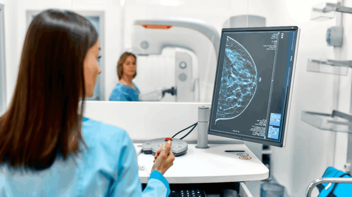 Tecnología contra el cáncer: el CONICET desarrolla una plataforma con IA para la detección temprana del cáncer de mama